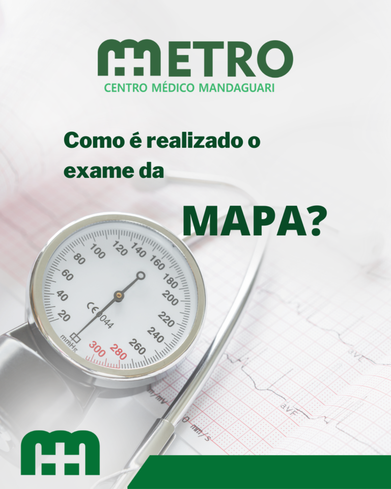 Como é realizado o exame da MAPA? Como é realizado o exame da MAPA?